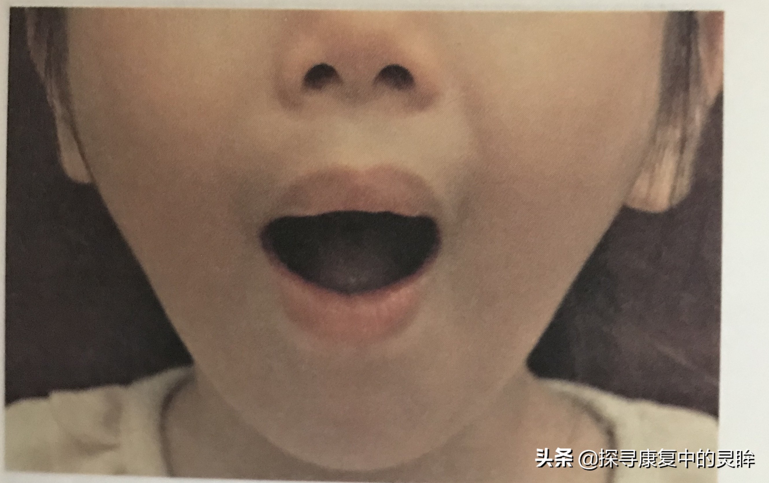 五种口部运动：灵活孩子的樱桃小嘴，让他们说话更清晰（超简单）