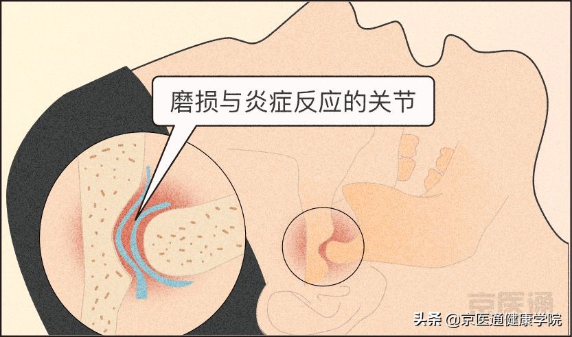 一招解决磨牙的危害,磨牙很严重最好的磨牙解决方法