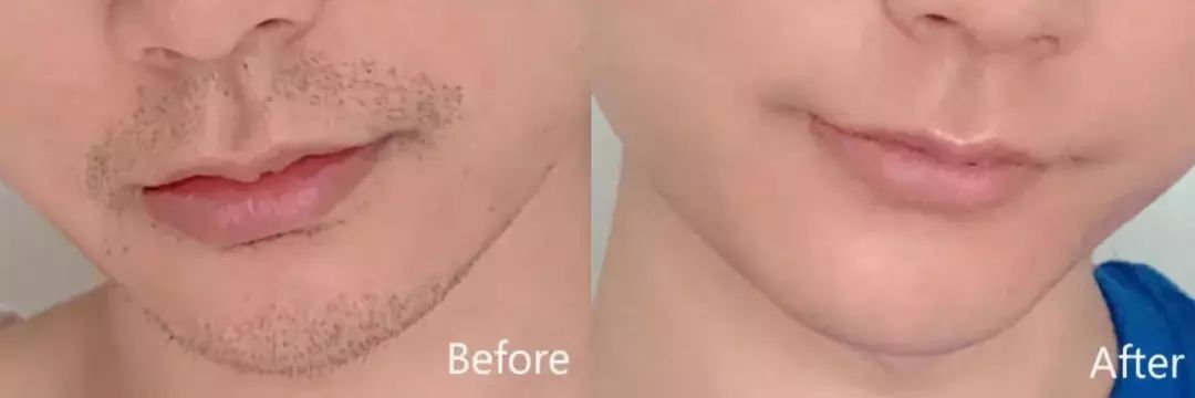 小米众筹59.9元剃须刀,小米众筹惊爆59元的剃须刀