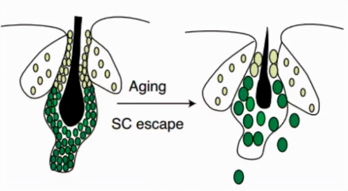 秃头是因为毛囊坏死吗,毛囊干细胞治疗秃头