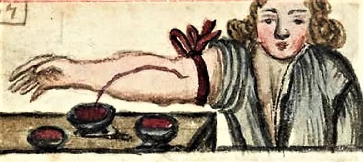 捅菊、放血、灌肠、*脑洗**……这些黑医术，你能扛过哪一招