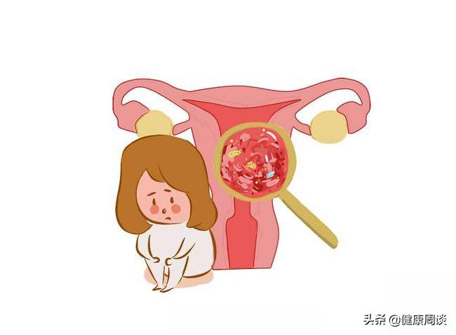 提醒女性：身体无端端出现4种迹象，千万别拖，尽快去医院排查HPV