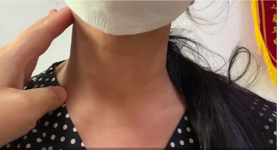 食堂阿姨手会抖是什么病,食堂阿姨手抖原来真是有原因的