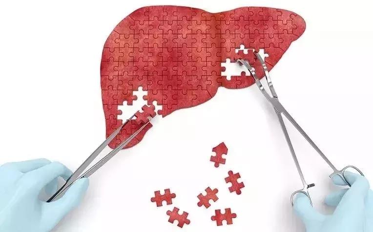 间充质干细胞能治肝纤维化吗,干细胞治疗肝硬化的最新研究