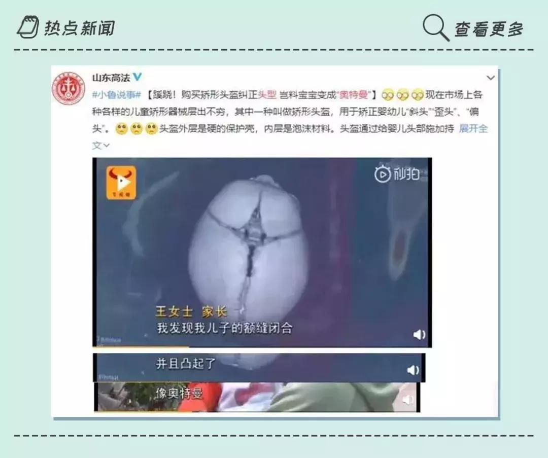 宝宝头睡偏了可以理哪种发型,头睡偏了怎么矫正儿童头型