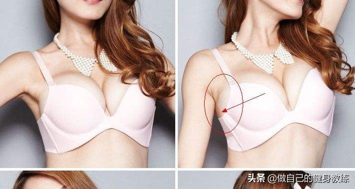 腋下副乳越长越大怎么办,腋下副乳一直出奶怎么办