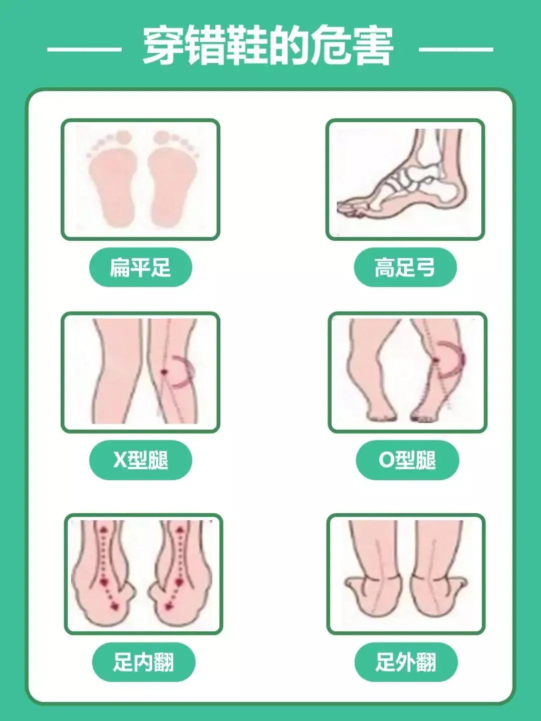 孩子坐扶梯脚被夹,儿童脚趾被卷进扶梯