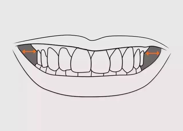 正畸主治学习视频,正畸钟摆效应名词解释
