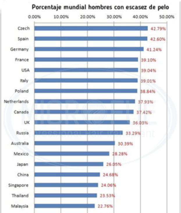 世界最帅的秃头男人,西班牙人秃顶