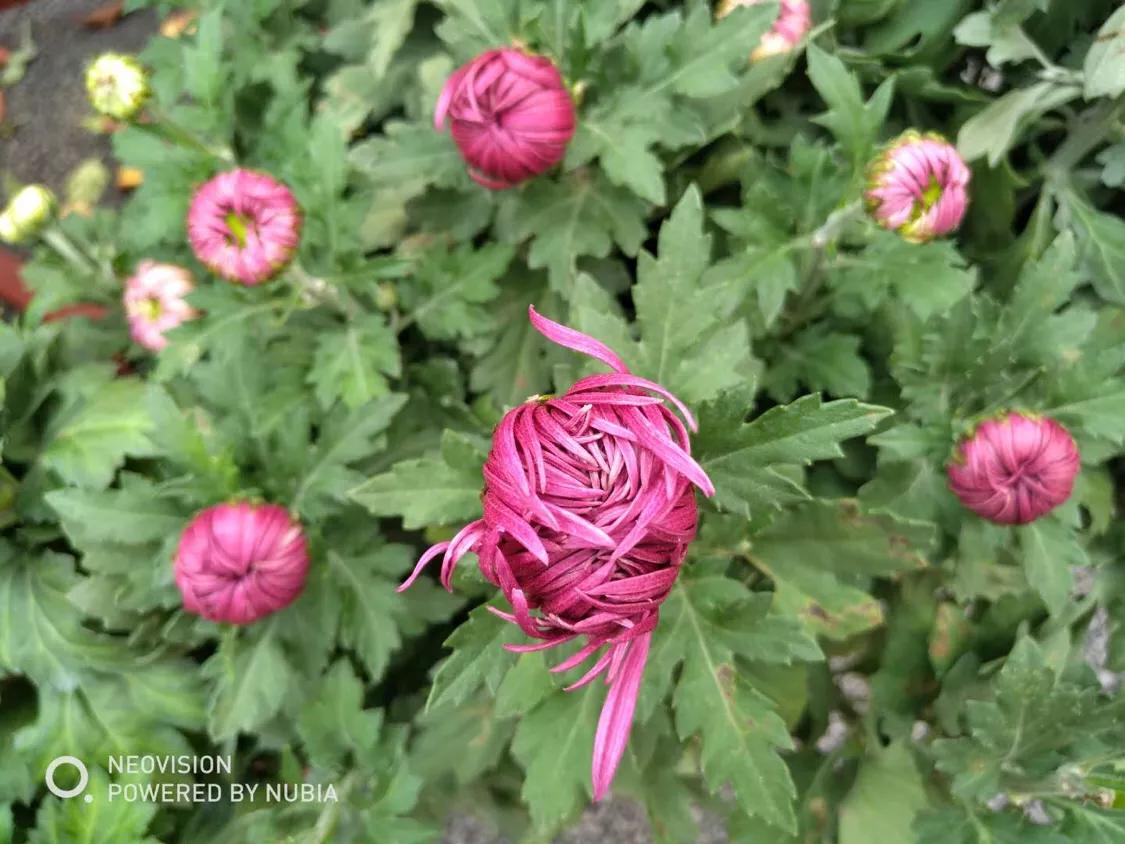 自闭症患者癫痫的10个前兆,自闭症加癫痫要先治疗哪一个