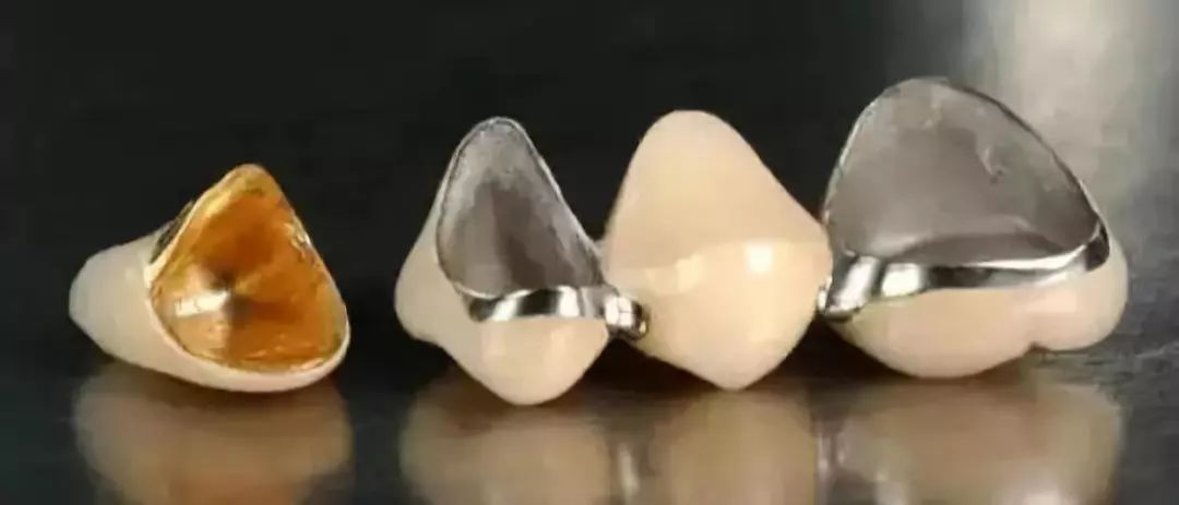 什么情况下牙齿需要做牙冠,牙齿抽掉神经需要戴牙冠吗