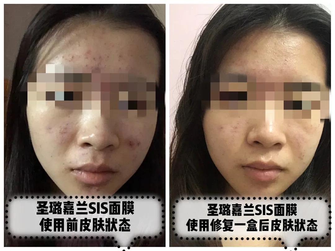 平价款前男友面膜,和前男友面膜差不多的面膜