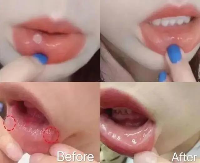 一张嘴就臭,一张嘴就口臭小妙招