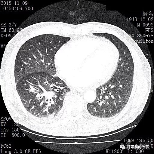 怎么应用统计学做调查,统计学方法可以解决的主要问题