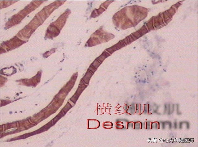 他汀的副作用肌痛怎么办,服用他汀导致的肌肉疼痛怎么缓解
