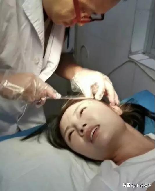 绯闻缠身的徐冬冬，被爆整形医院出事故，被紧急送往抢救