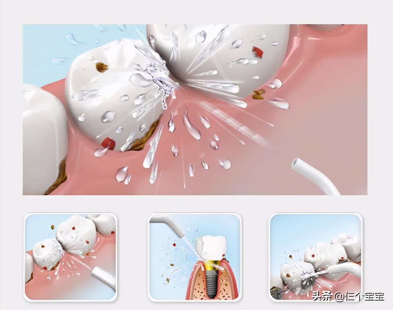 草莓籽在嘴里发了芽？刷牙少了这一步，你真的只是刷了个寂寞