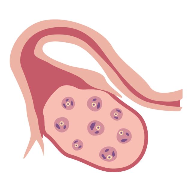 「试管小白」为提高成功率，打降调多取几个卵吧