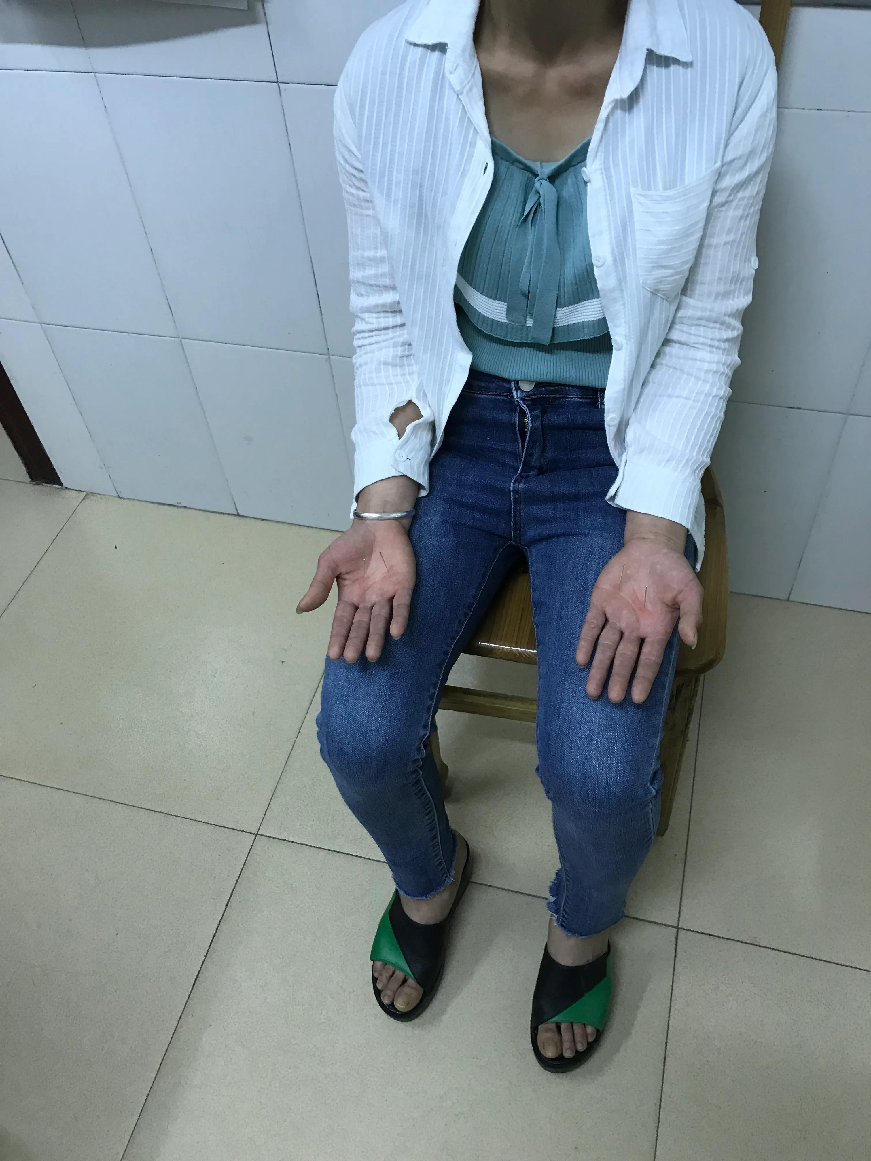 双足底麻痛是怎么回事,双足脚底疼痛的原因