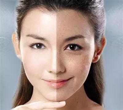 一碗姜蜜水坚持喝祛斑显年轻,柠檬加姜蜜祛斑