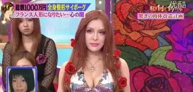 日本妹子花1286万元整容成芭比娃娃?!见识到了“可怕”……