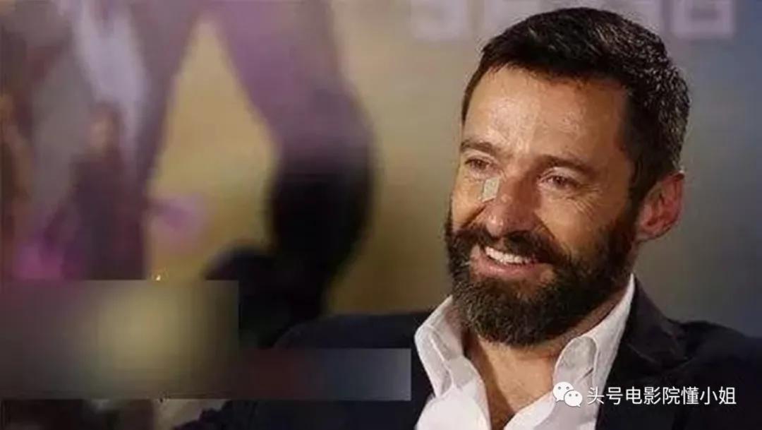 金刚狼爆皮肤癌危机！53岁休杰克曼提醒抹防晒霜，4年前曾动手术