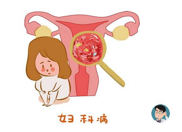为什么女人总得妇科病,洗太干净就容易得病吗