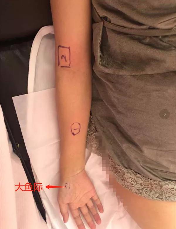 又有孕妈中招！一位24周孕妈妈的耻骨分离经历