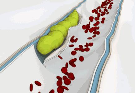 检查甘油三酯前喝了饮料,每天1瓶330毫升可乐有问题吗