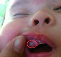 新生儿7个看似异常、其实正常的生理现象，你知道几个？建议收藏