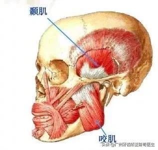 戴牙套会有下颌线,戴牙套的时候人会变丑吗