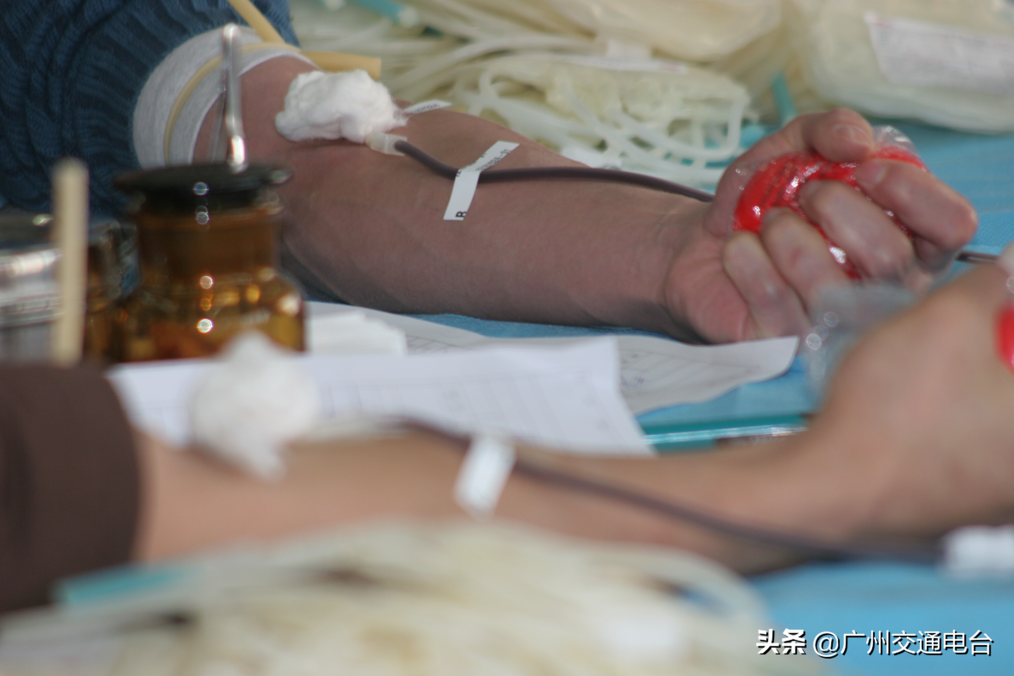 广州筛查到罕见Di,b-血型并输注为国内报道第10例