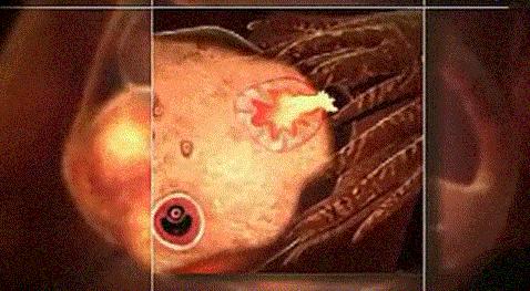 为什么花2块钱买个排卵试条就能解决的事，医生让你花150做B超？