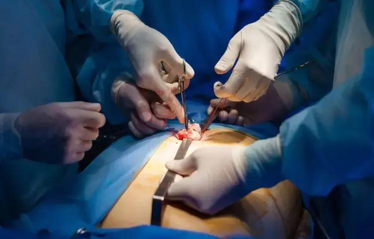 女人胆囊切除后对生孩子有影响吗,胆囊切除后影响以后的正常生活吗