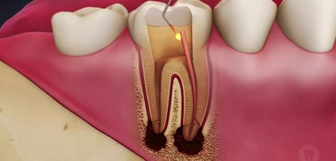 一场骗局的真相,美国牙医靠谱吗