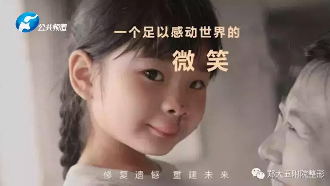 郑州医学院整形美容,郑州大学第一附属医院整形美容科