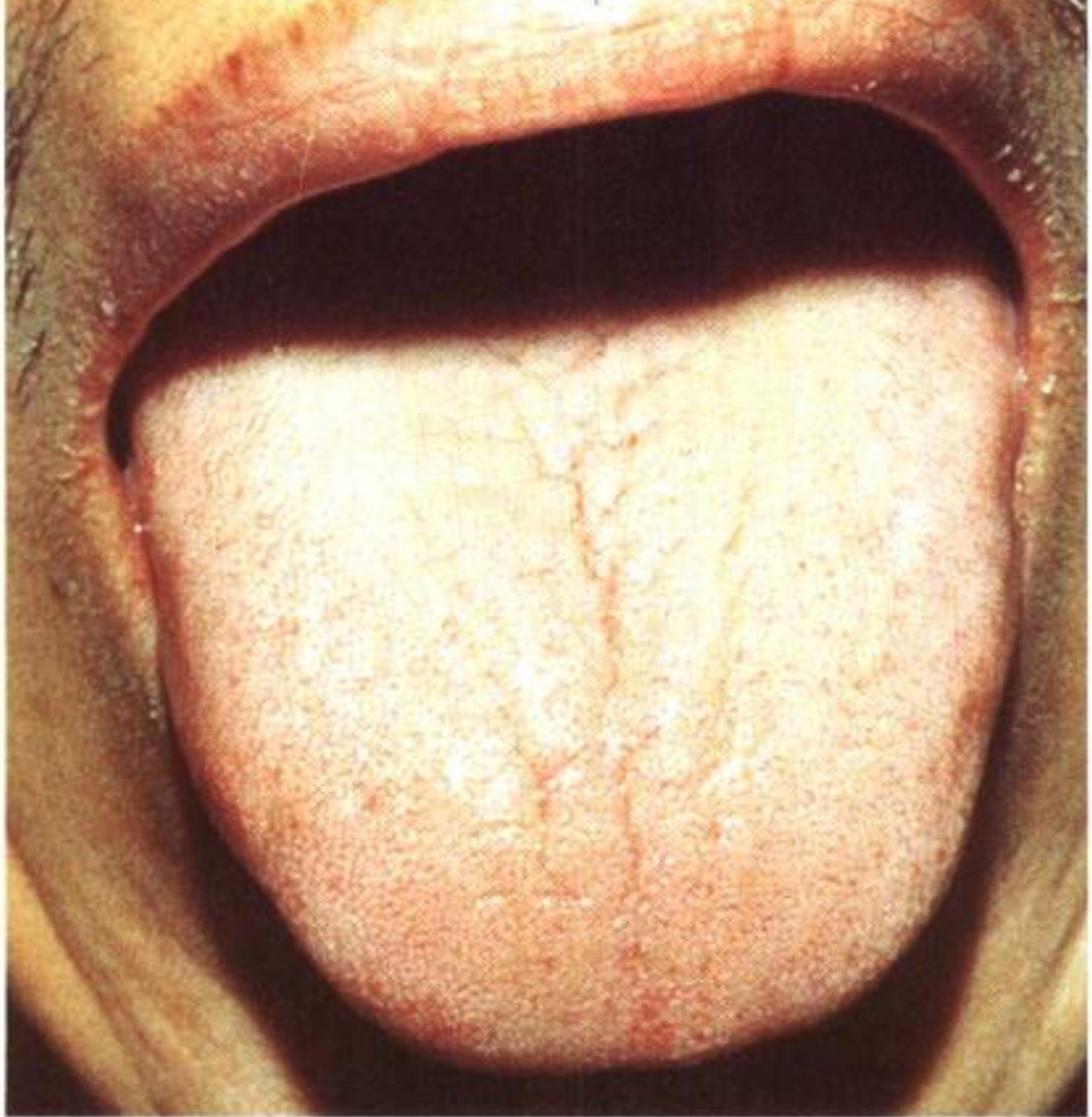 如何从舌苔判断健康,怎样通过舌苔颜色判断身体状况