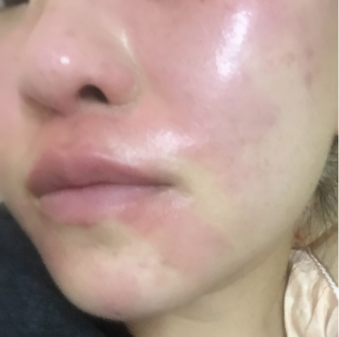 颜佳宜固体面膜真的那么好用吗,医用面膜真的那么好用吗