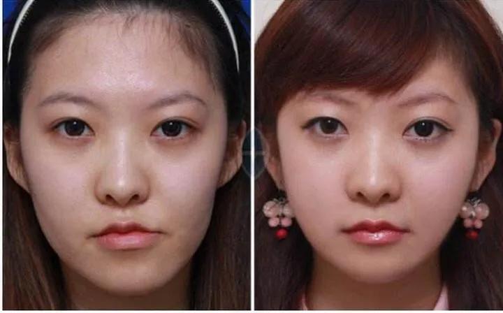 比整容更有效的变美习惯,不整容不动刀的变美秘籍