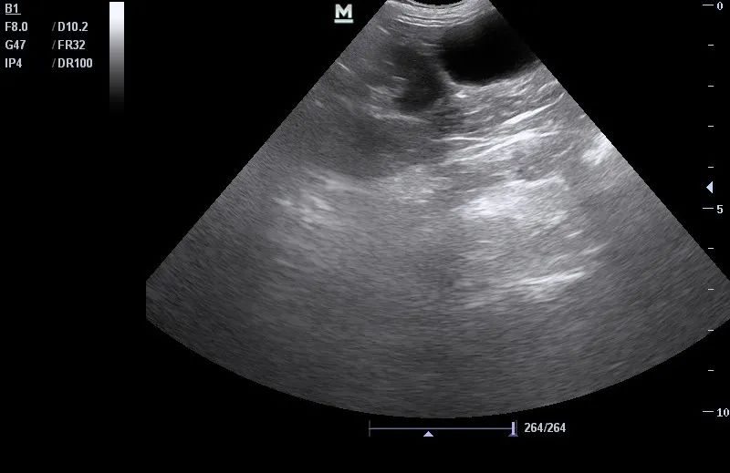 ​猫咪“甜蜜的负担”，当患有糖尿病时，应如何治疗？