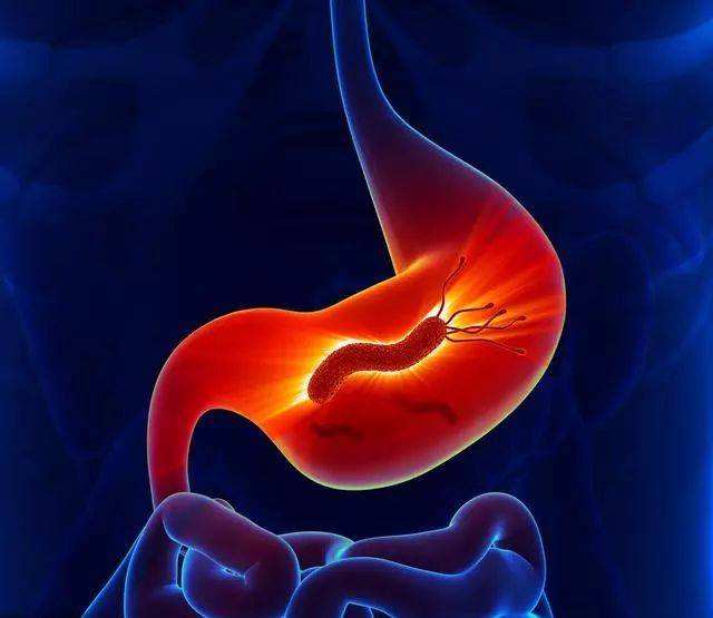一半中国人感染的幽门螺旋杆菌怎么根治?