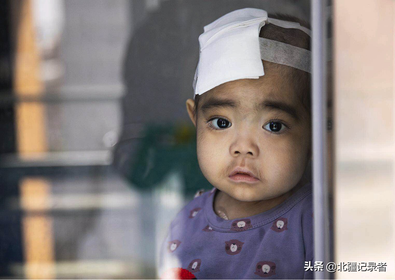 罕见病泡泡男孩,泡泡男童