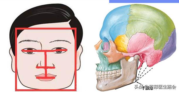 120度的下颌角容易变成方形脸吗,90度下颌角看着好难看啊