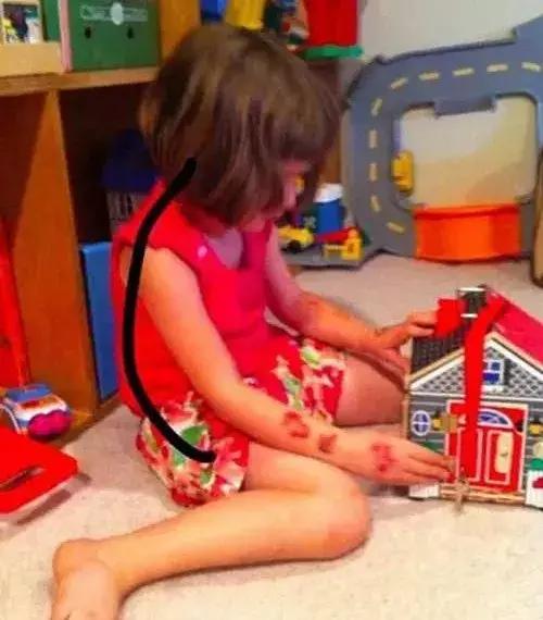 o型腿宝宝怎么坐是正确姿势,儿童o型腿怎么坐