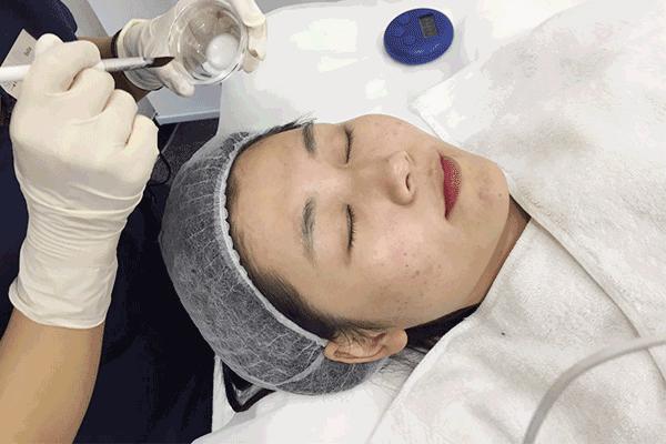 爱长痘的人一直长痘,爱长痘痘的皮肤