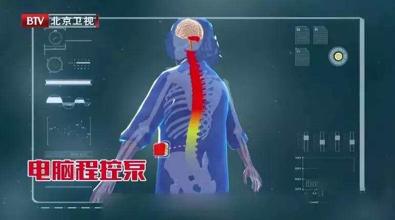 腰痛警惕癌症早期10种信号女,为什么腰痛是癌症的前兆