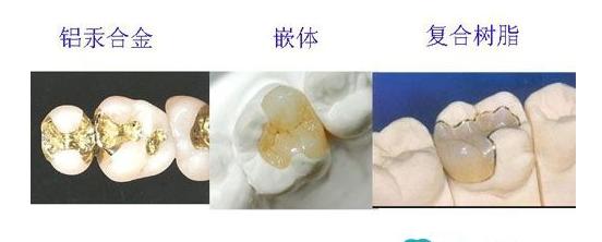 我的牙齿没了就剩牙根了怎么办,我的牙齿掉了一半里面空了怎么办