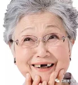 缺牙不镶牙你不知道的危害,缺牙不镶牙的不良影响示意图