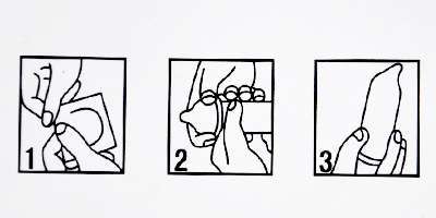 预防怀孕的避孕措施有几种方法,避孕措施没做好意外怀孕能要不