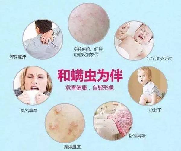 螨虫感染皮肤的症状用什么药,螨虫的最佳防治方法